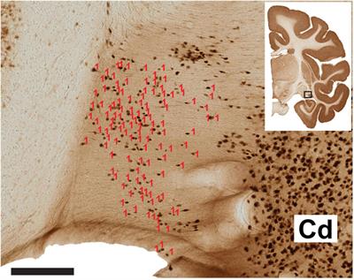 Complex Neurochemical Microstructure of the Stria Terminalis in Infant and Adult Macaque Monkey